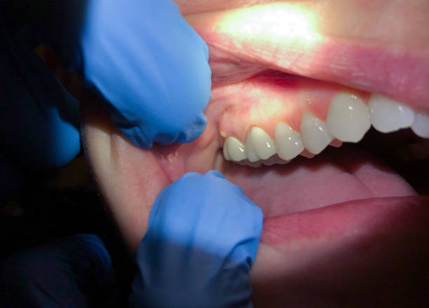Trusted MS Emergency Dentist Experts