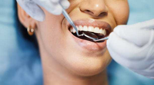 Best Emergency Tooth Extraction  in Blue Mountain, MS
