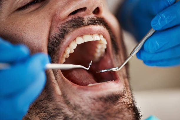 Best Dentist Open Late Near Me  in Blue Mountain, MS